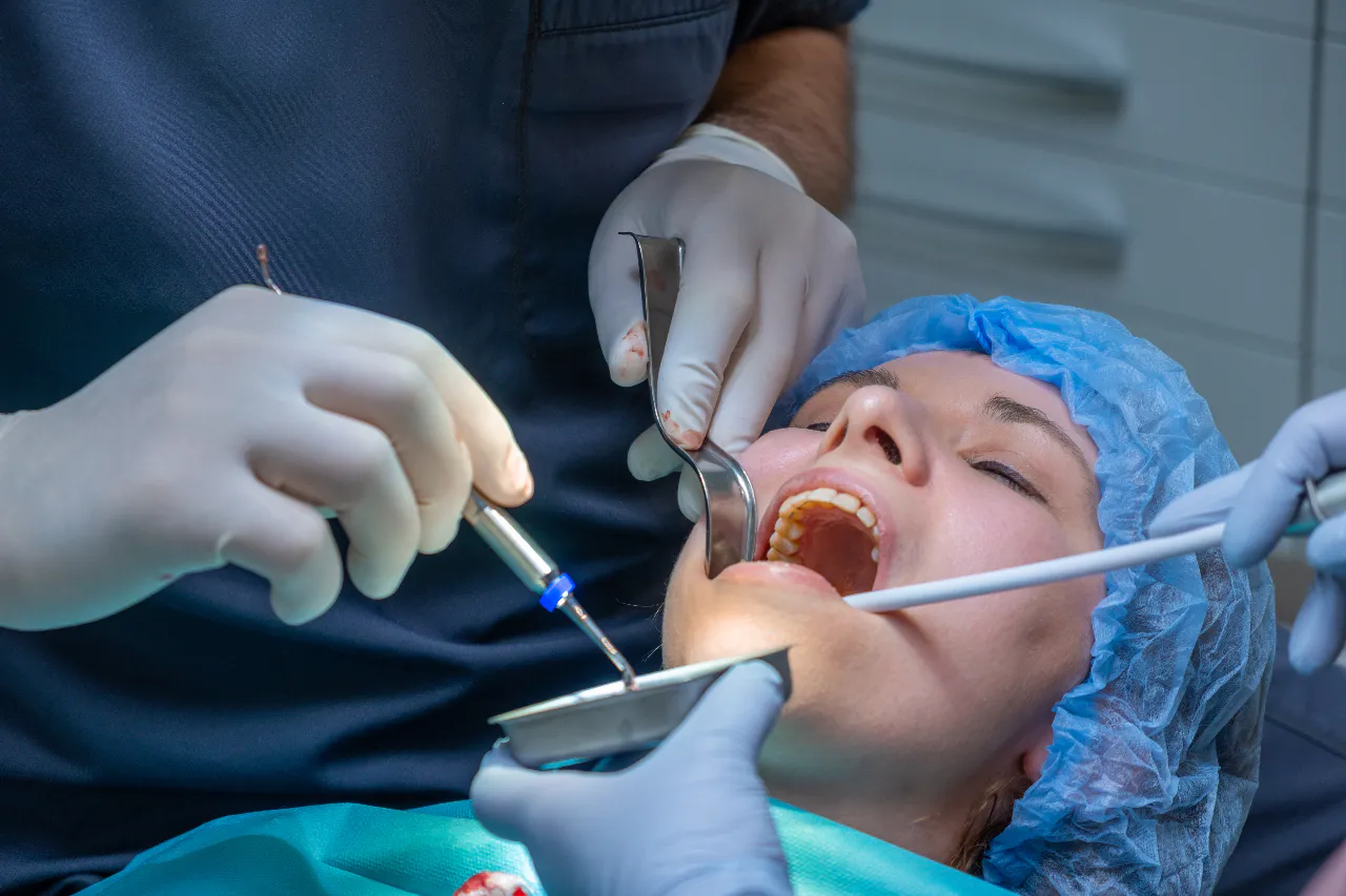 A bone graft being placed to prepare the jaw for a dental implant
