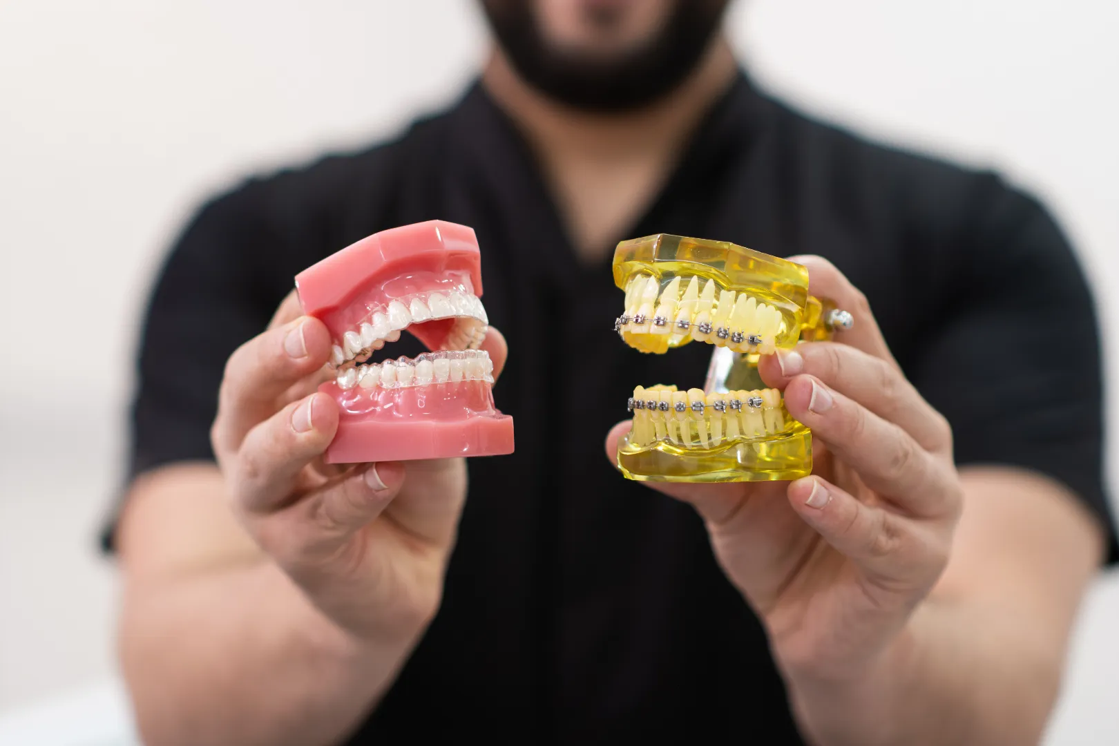 Clear aligners versus braces comparison
