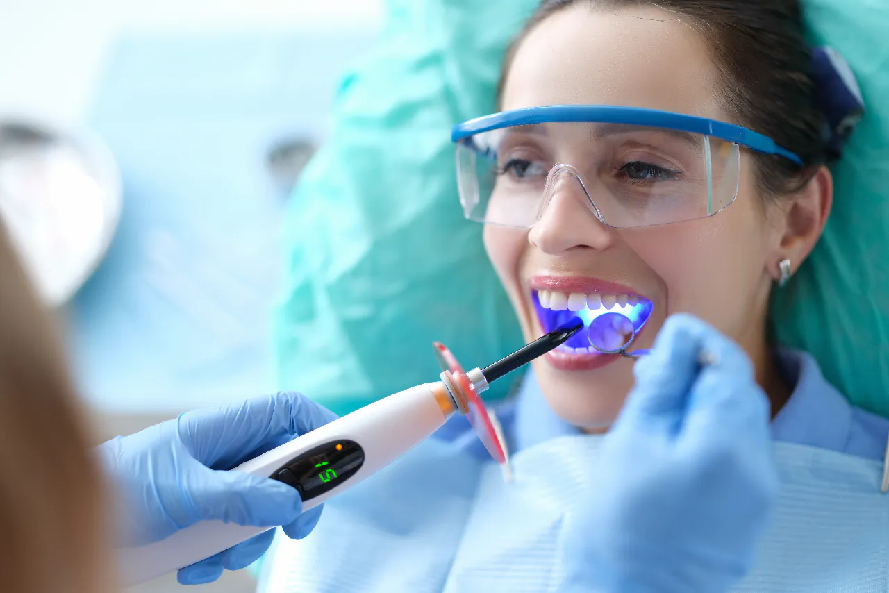 Dental bonding resin being cured on a front tooth
