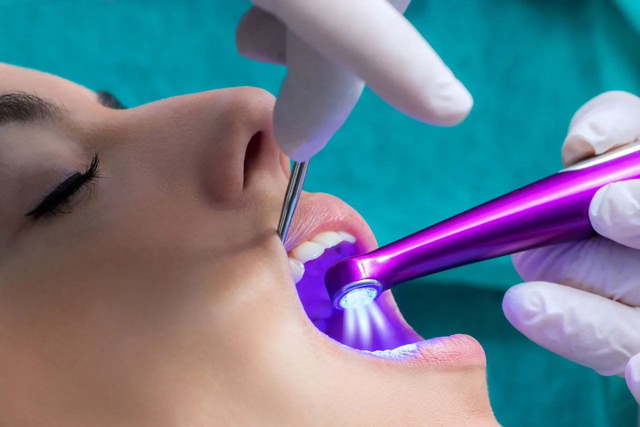 Dental sealants protecting back teeth