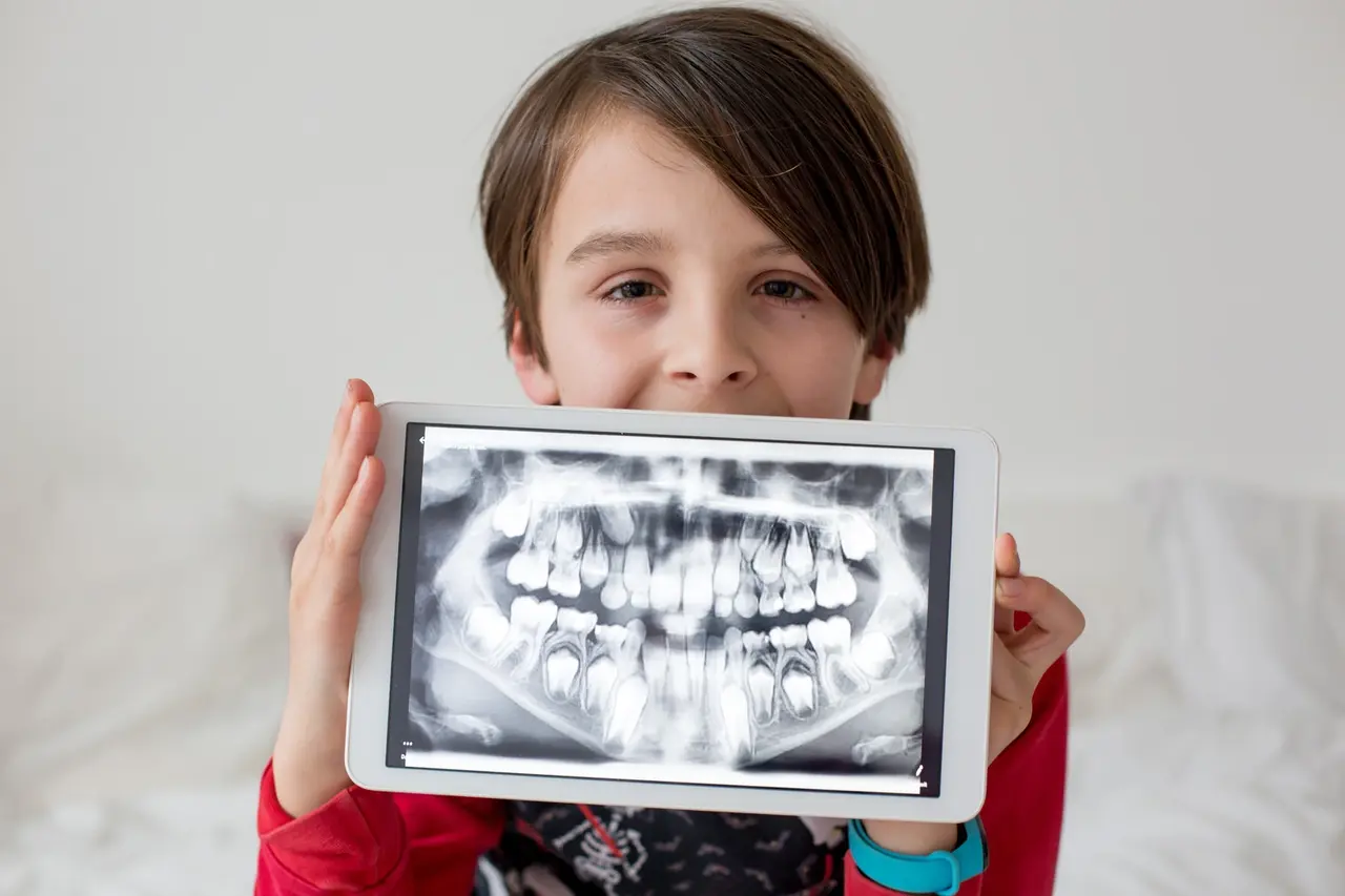 Digital dental x-ray imaging